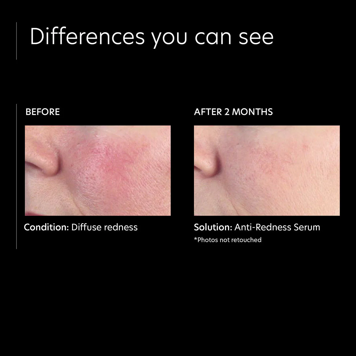 1645-anti-redness-serum-3.webp Anti-Redness Serum