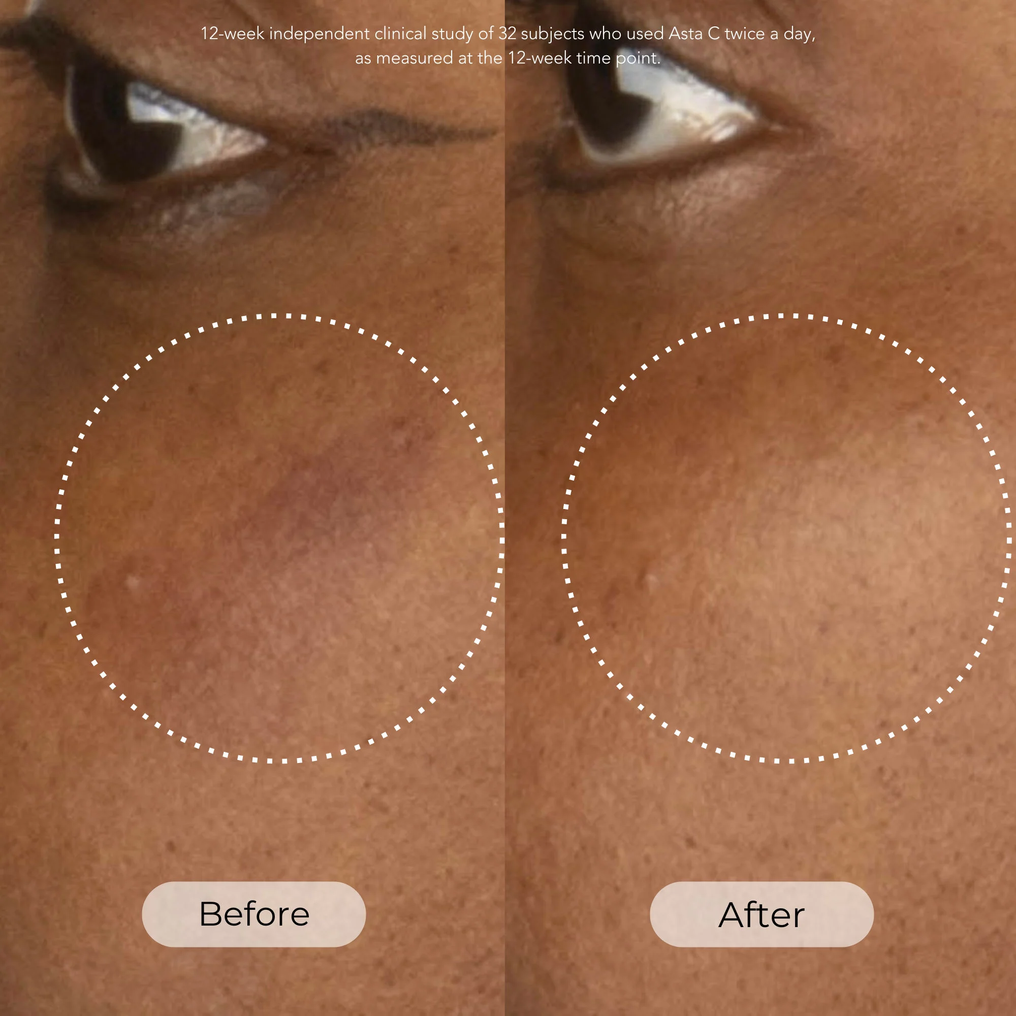 Asta C Vitamin C Age Defense Serum