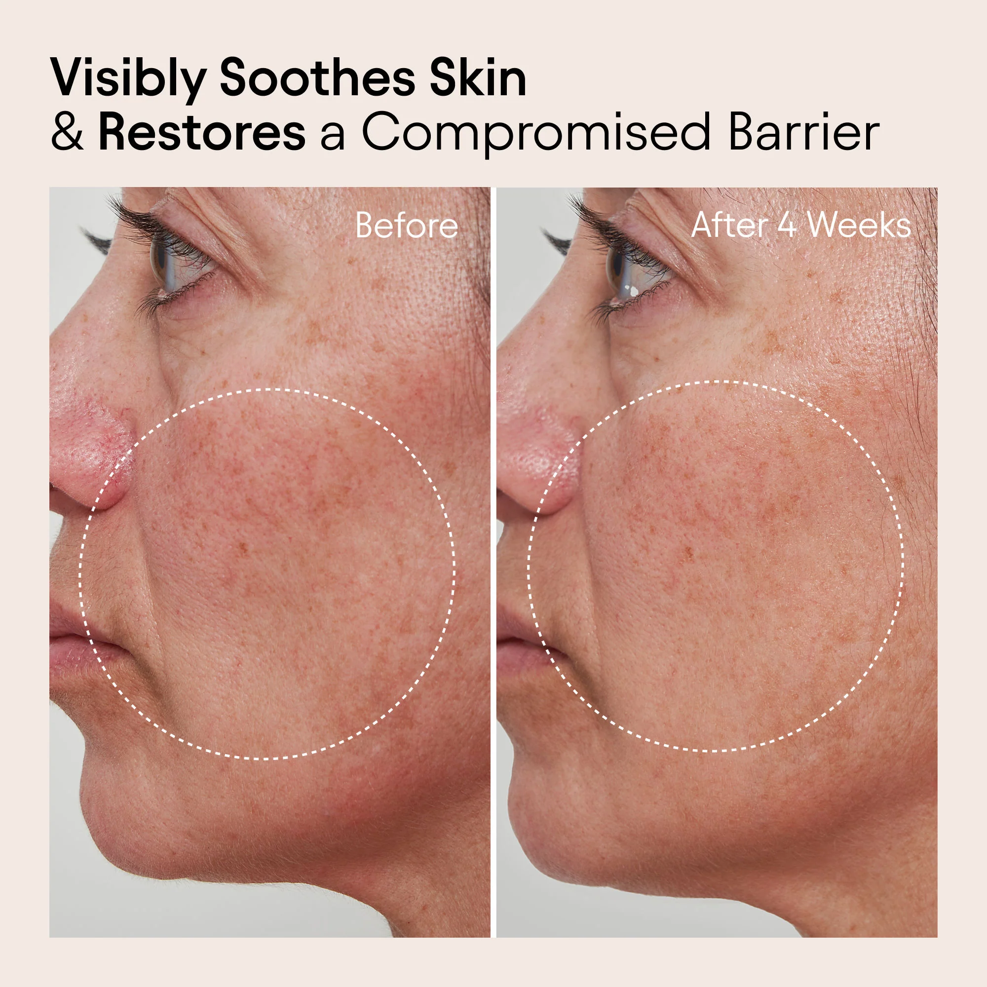 1943-barrier-repair-cream-moisturizer-for-eczema-wrinkle-and-barrier-repair-4.webp Barrier Repair Cream Moisturizer for Eczema, Wrinkle and Barrier Repair