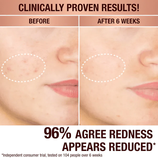 3678-dark-spot-correcting-radiance-recovery-serum-6.webp Dark Spot Correcting Radiance Recovery Serum