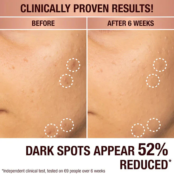 3678-dark-spot-correcting-radiance-recovery-serum-7.webp Dark Spot Correcting Radiance Recovery Serum