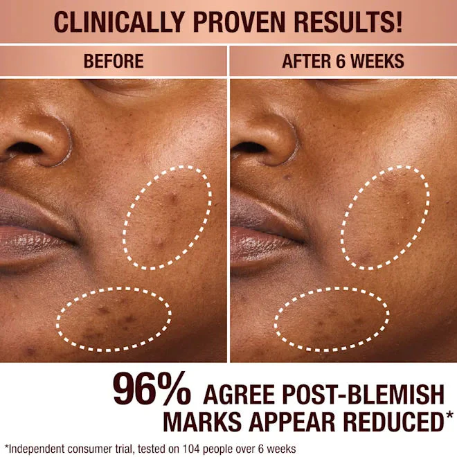 3678-dark-spot-correcting-radiance-recovery-serum-8.webp Dark Spot Correcting Radiance Recovery Serum