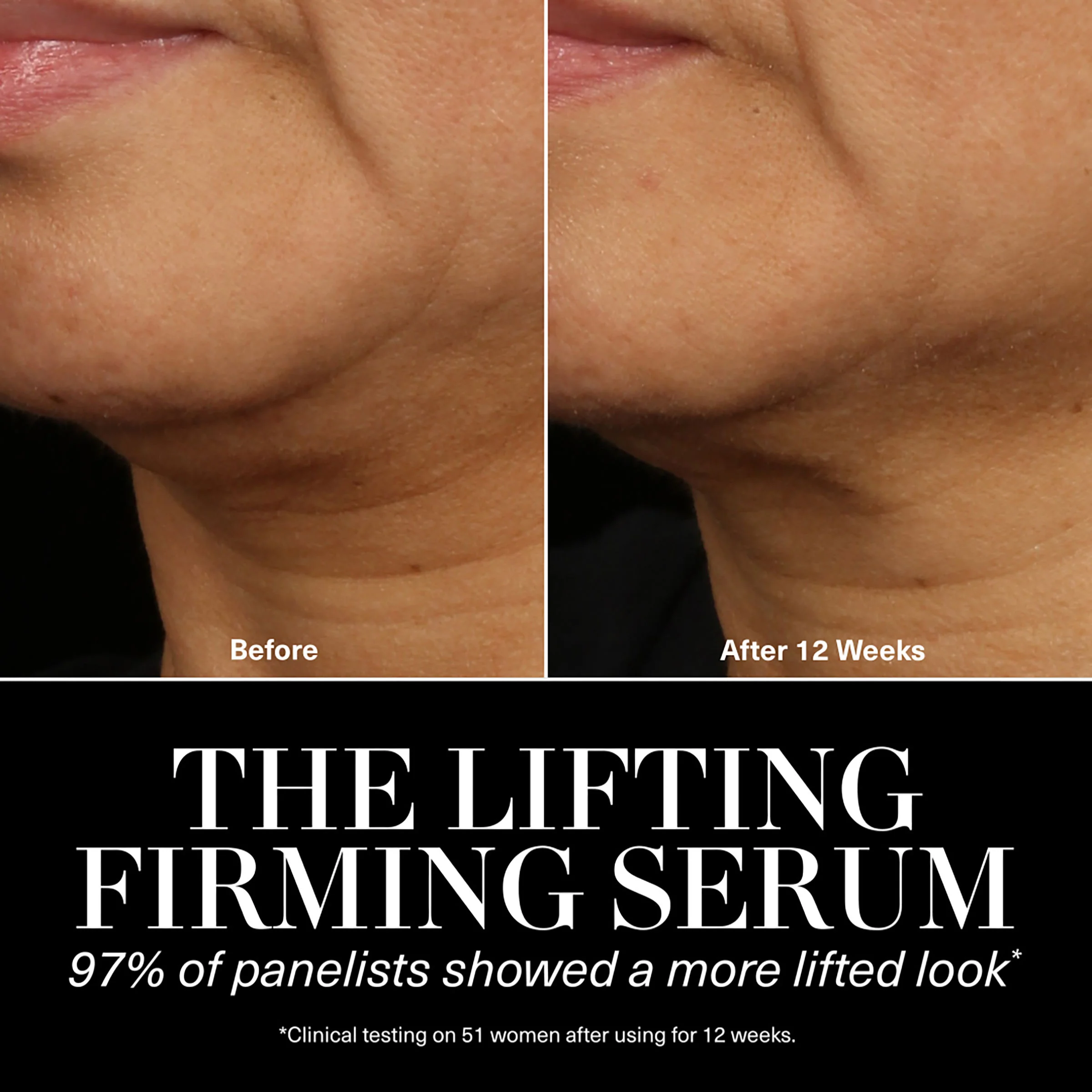 436-the-lifting-firming-serum-3.webp The Lifting Firming Serum