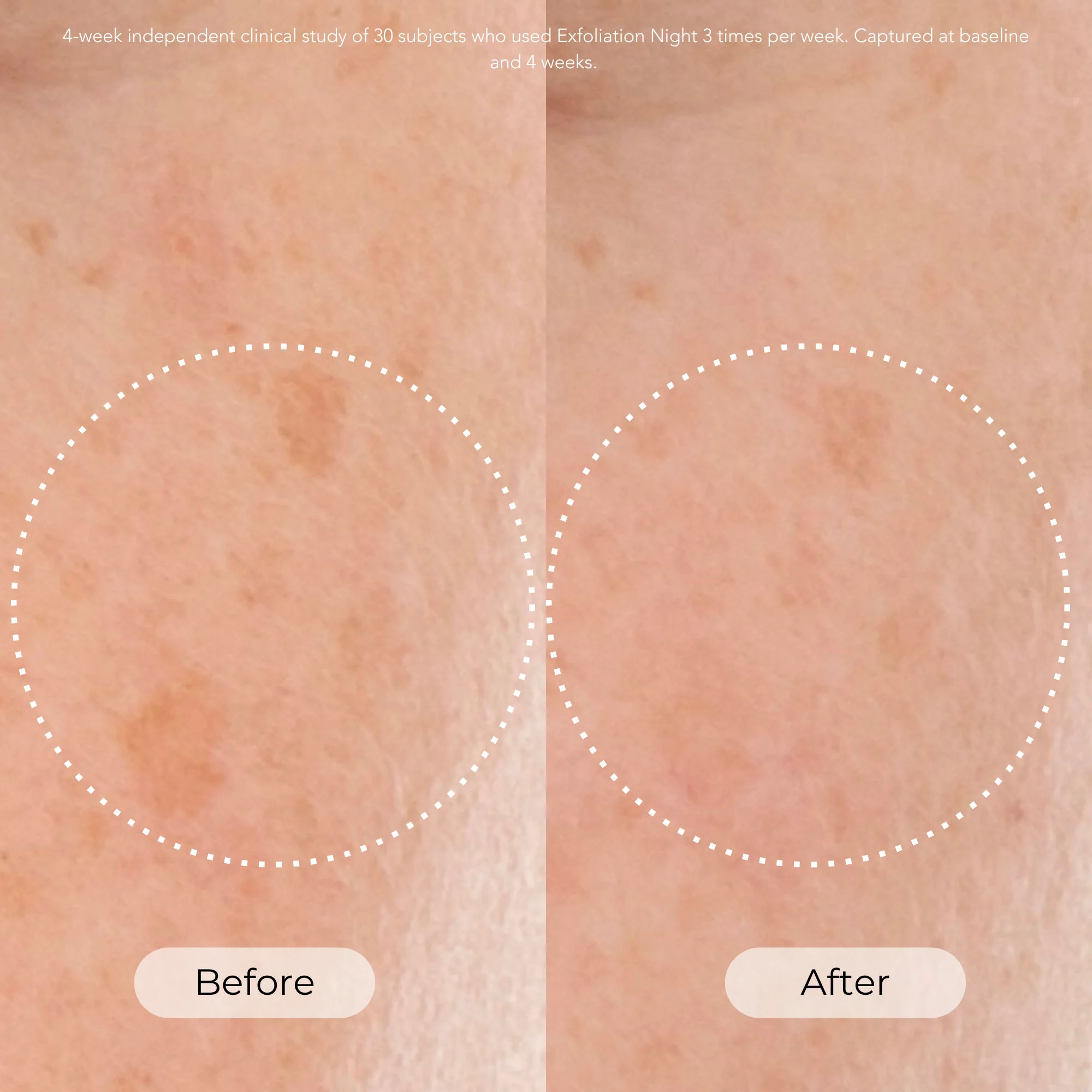 Exfoliation Night Resurfacing and Brightening Serum