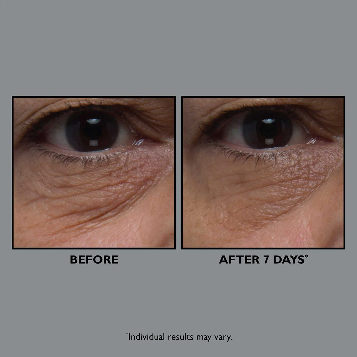 4849-firmx-collagen-eye-cream-3.webp FirmX Collagen Eye Cream