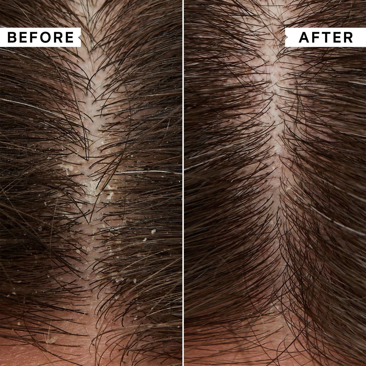 Flaky Scalp Calming Toner