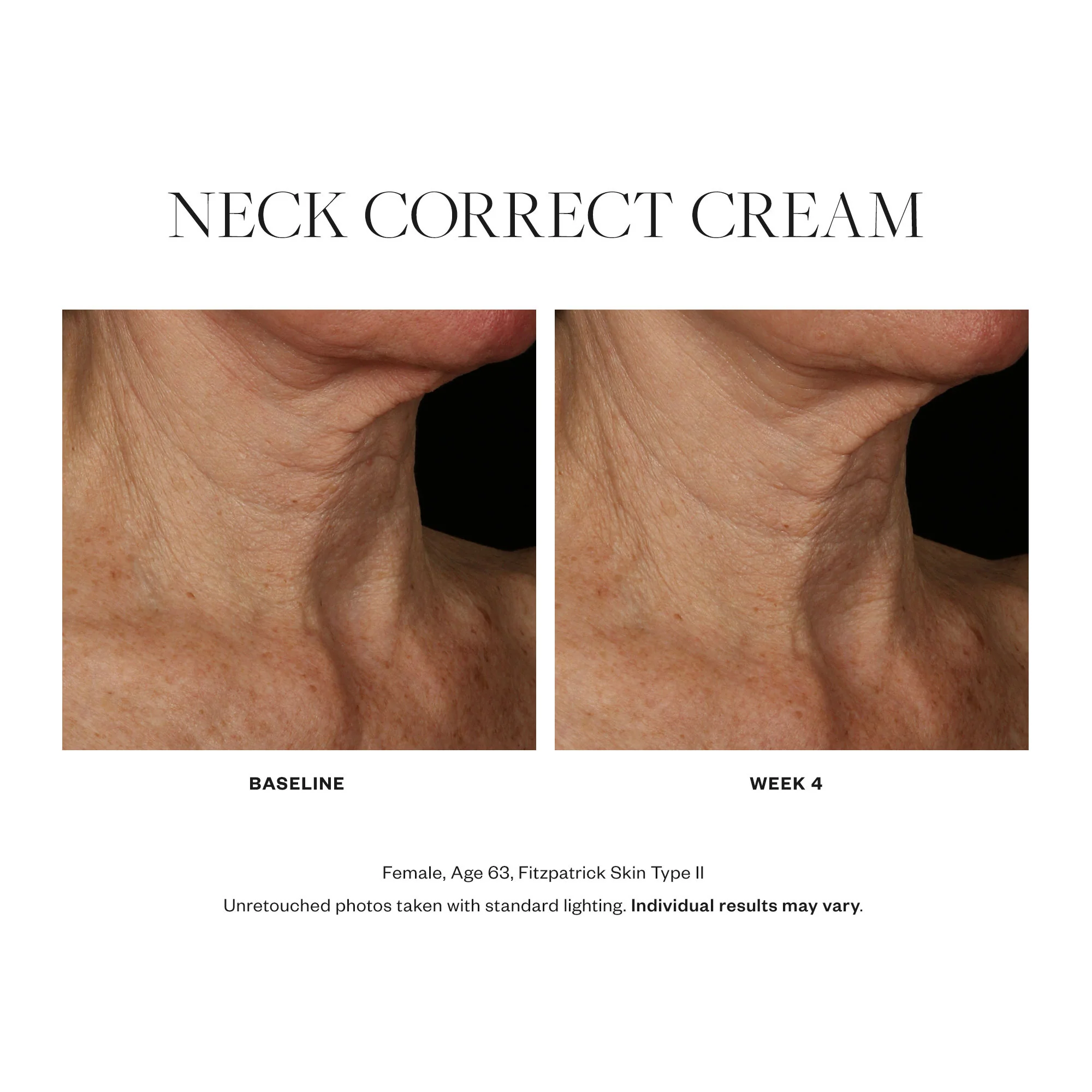 7736-neck-correct-cream-4.webp Neck Correct Cream