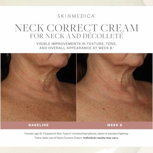 7736-neck-correct-cream-5.webp Neck Correct Cream