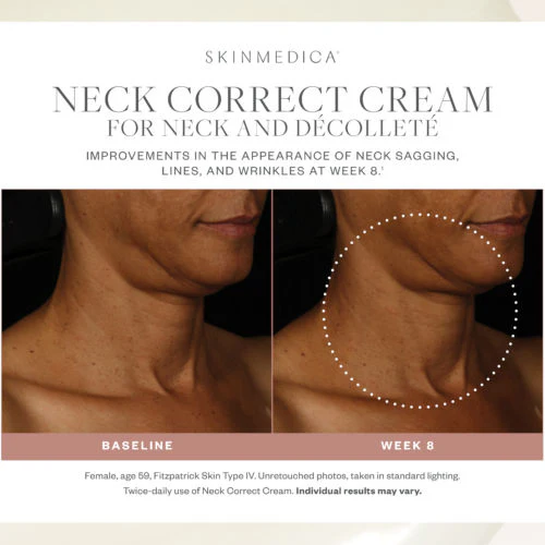 7736-neck-correct-cream-6.webp Neck Correct Cream