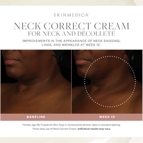 7736-neck-correct-cream-7.webp Neck Correct Cream